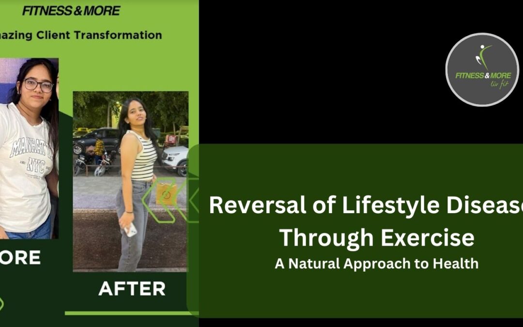 Reversal of Lifestyle Diseases Through Exercise: A Natural Approach to Health